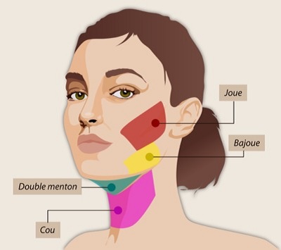 Liposuccion visage Tunisie : Tout savoir