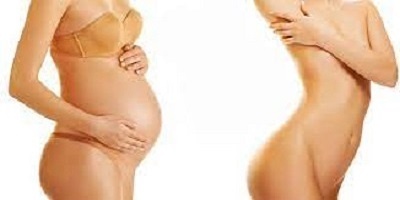 Liposuccion : combien de temps faut-il attendre après un accouchement ?