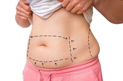 ventre insensible apres une abdominoplastie