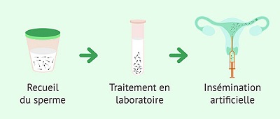 insémination artificielle tunisie